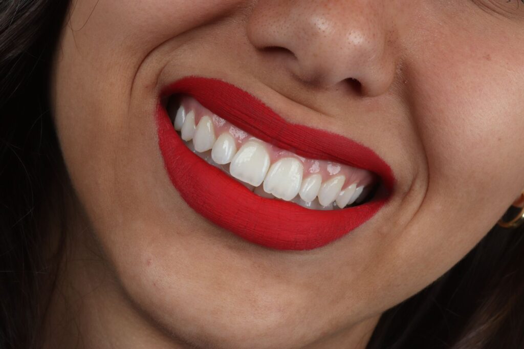 clareamento dental